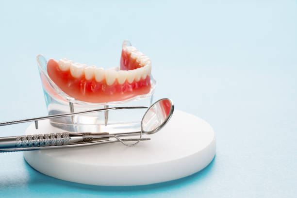 Dental Bonding in Madisonville, LA